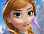 Play Free Anna Great Makeover