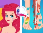Ariel's Legs Surgery