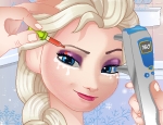 Play Free Elsa Eye Doctor