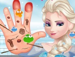 Play Free Elsa Hand Doctor