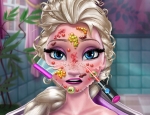 Play Free Elsa Skin Doctor