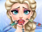 Play Free Elsa Tooth Injury