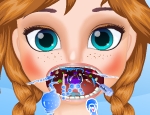 Play Free Frozen Anna Throat Care