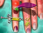 Play Free Hand Skin Doctor