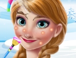 Play Free Ice Princess Real Makeover