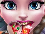 Play Free  Ice Queen Tongue Doctor 