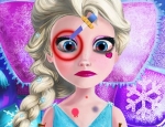 Play Free Injured Elsa Frozen