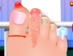 Play Free Nail Surgery And Foot Spa