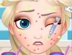 Play Free Squeeze Elsa Pimples